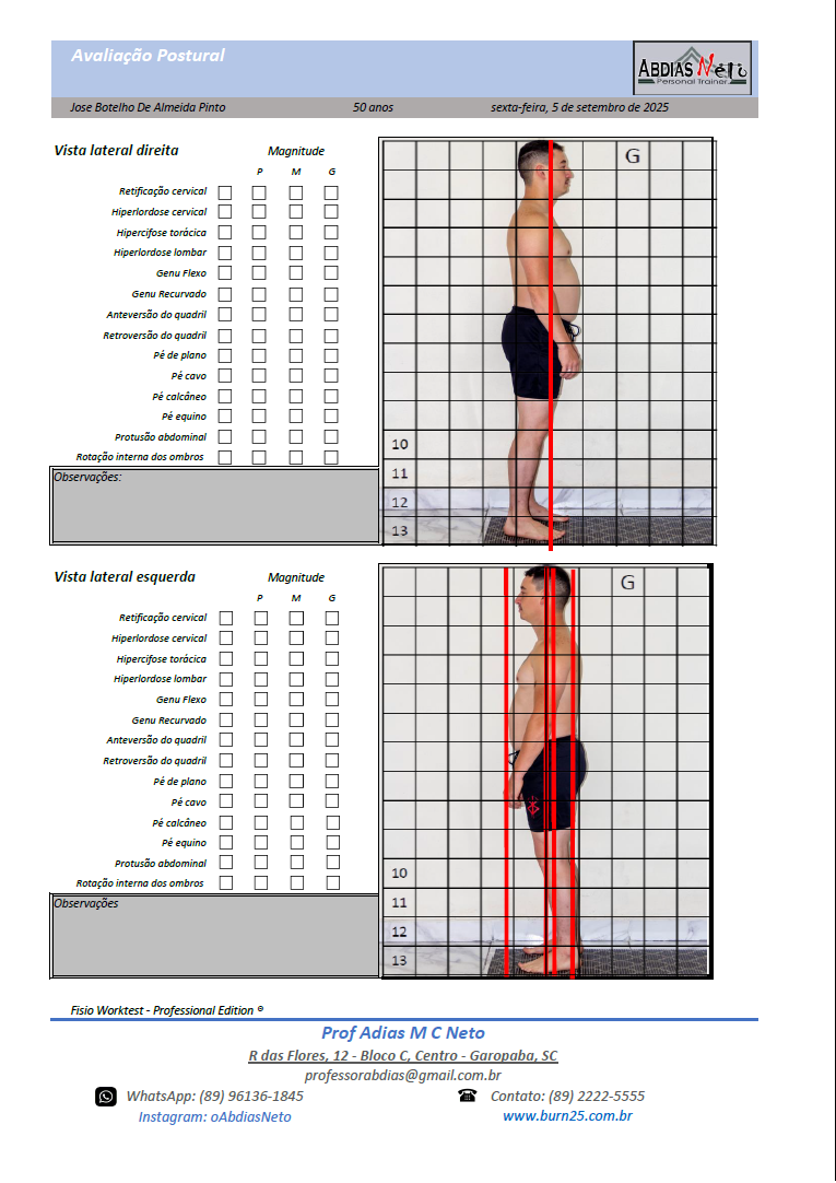 Fotogrametria anatômica
